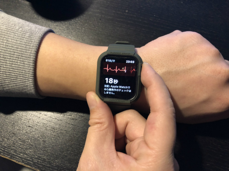 Apple Watch心電図（ECG）が日本でも解禁！設定方法＆使い方の解説 | スマウォッチ